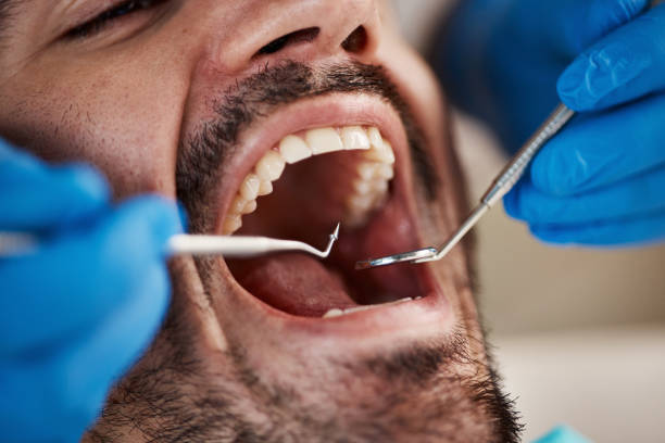 Best Weekend Emergency Dentist in Town Line, NY